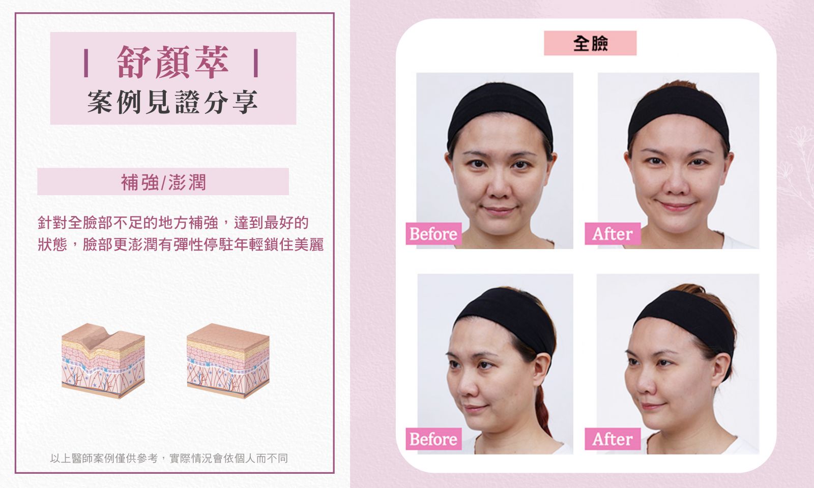 舒顏萃_BA_古婉君