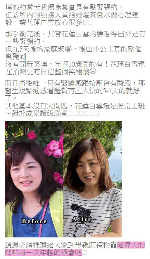 給媽媽的母親節大禮~東區美麗爾診所-埋線拉提 @ 後山小公主愛推薦