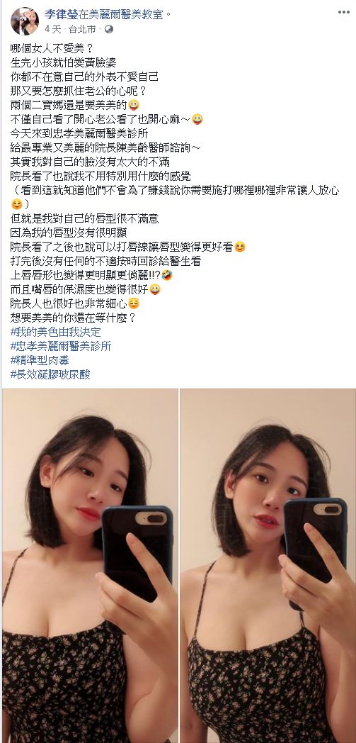 飯糰媽 小律FB  玻尿酸 豐唇