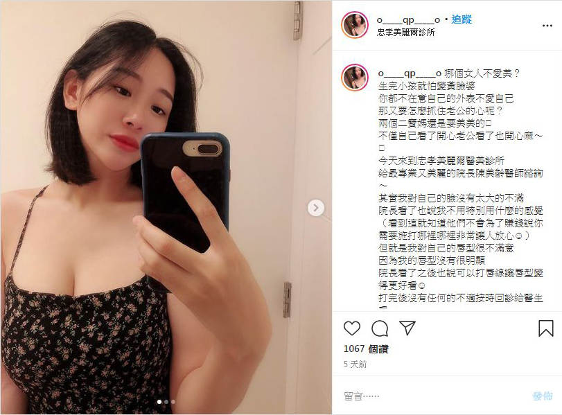 飯糰媽 小律IG 玻尿酸 豐唇