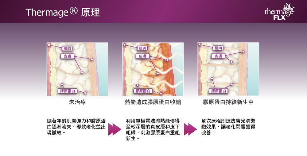 鳳凰電波原理