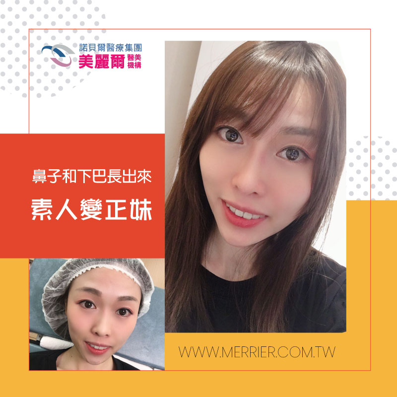 CLEVIEL玻尿酸