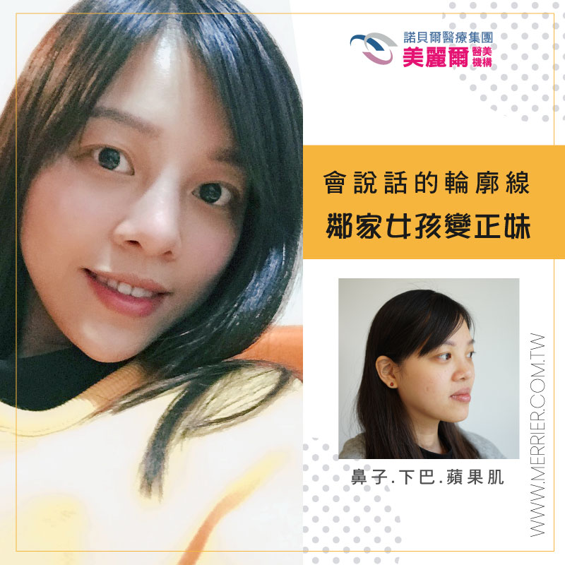 CLEVIEL玻尿酸