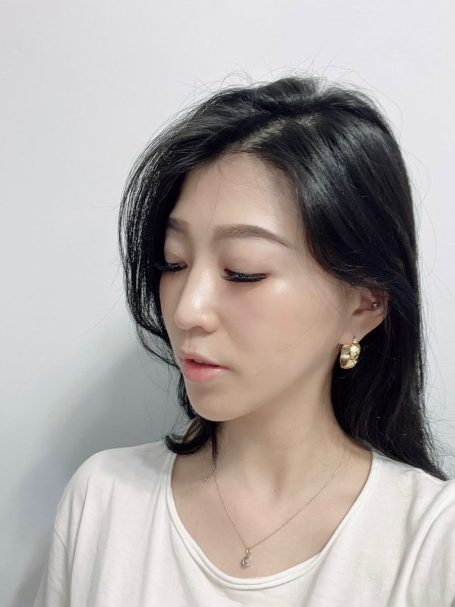 埋線拉提 術後