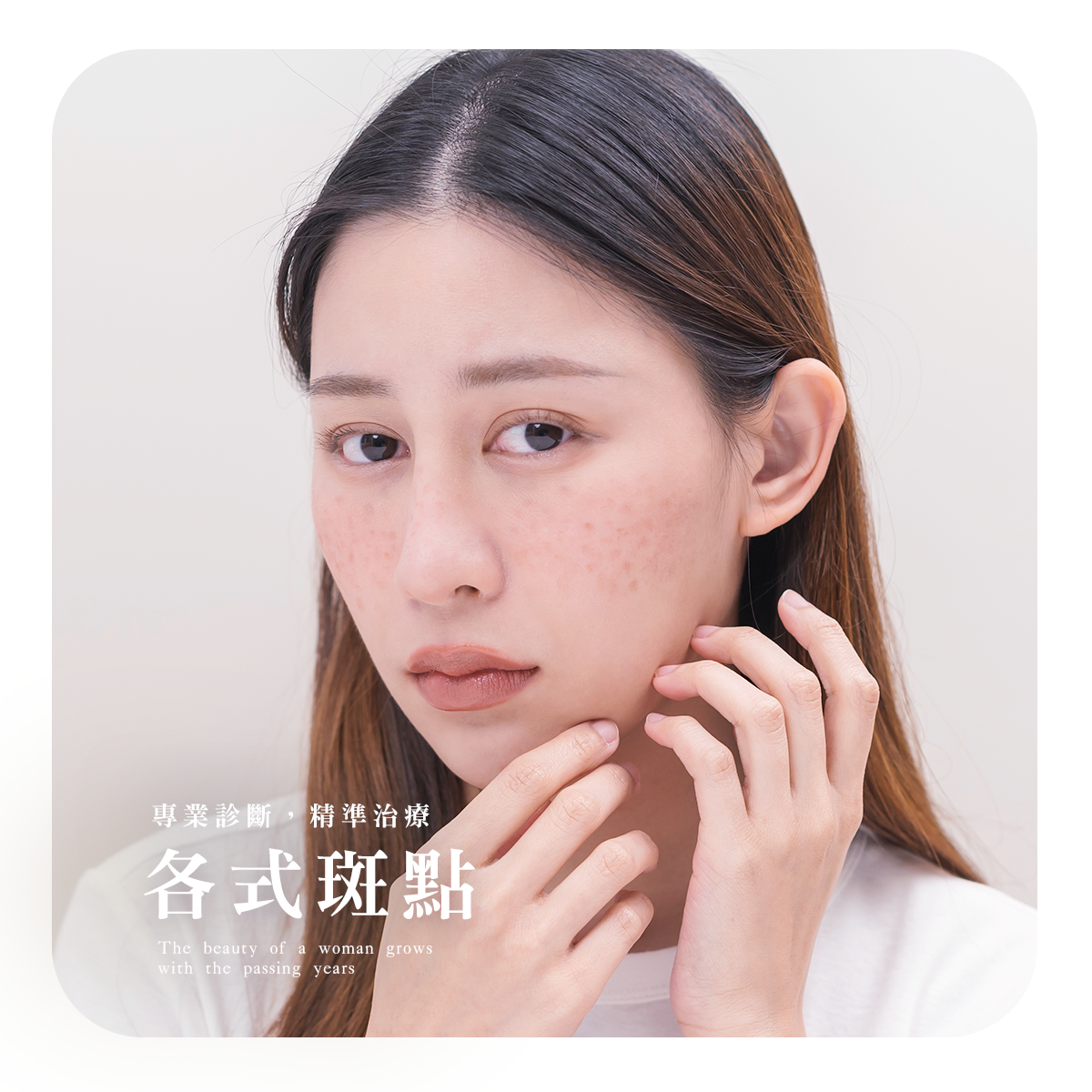 各式斑點