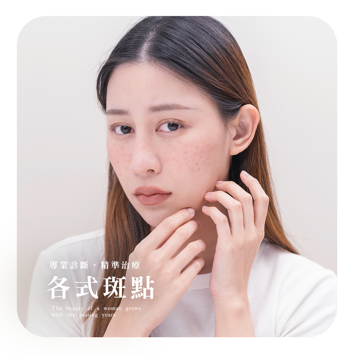 各式斑點
