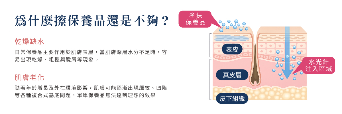 水光針適合用於改善乾燥缺水毛孔粗大等初老問題