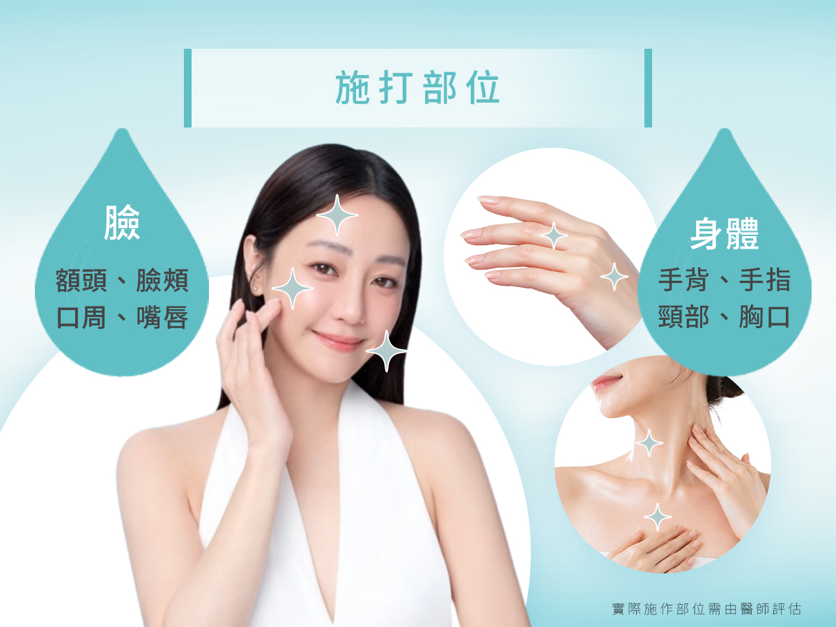 SKINVIVE® 聚光針 - 施打部位