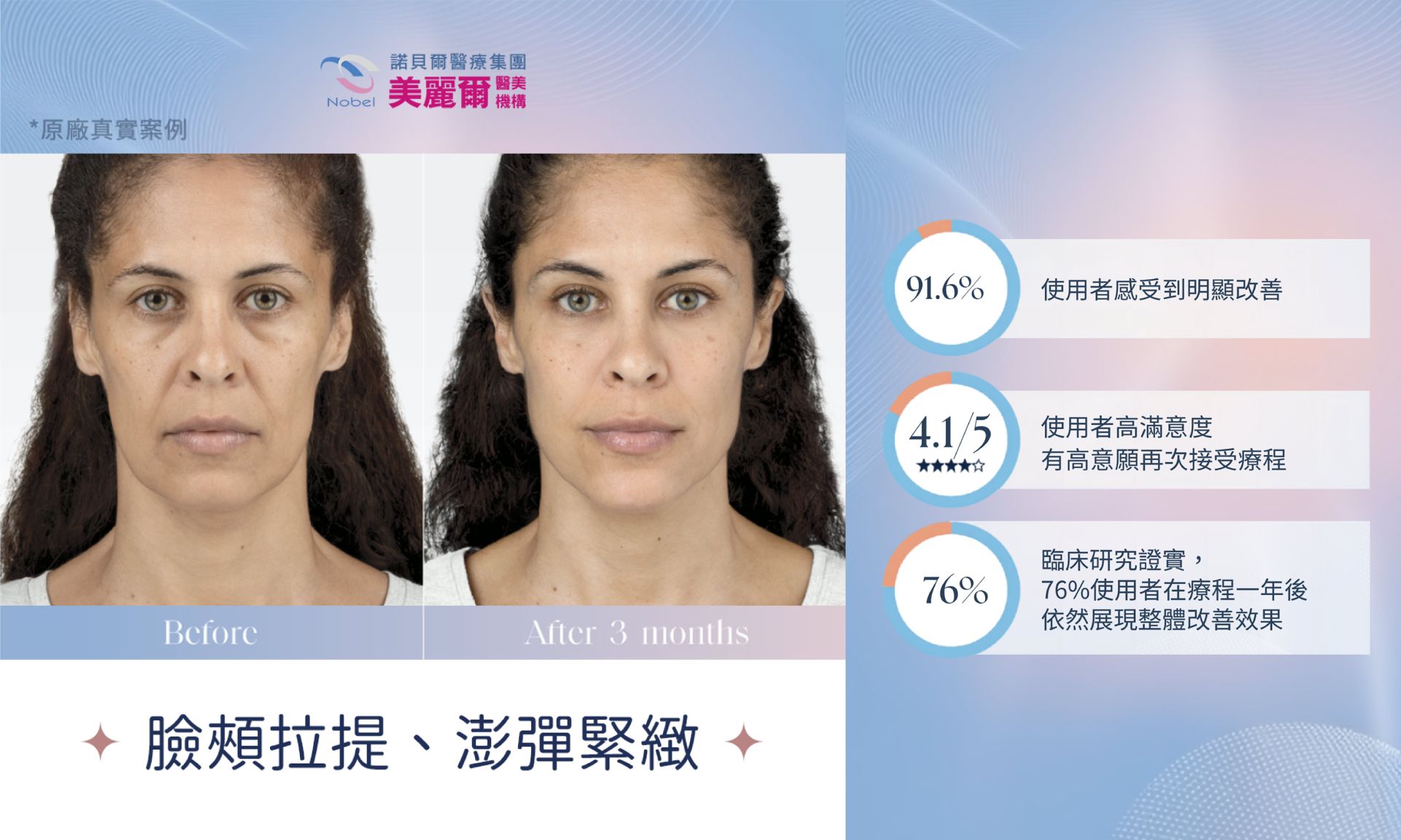 媄神針療程特色